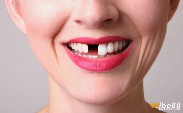 Mơ thấy nhổ răng cho người lạ thể hiện mong muốn giúp đỡ người khác của bạn